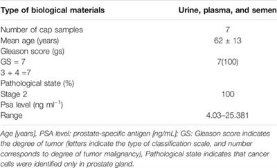 Untargeted Metabolomics Study of Three Matrices: Seminal Fluid, Urine, and Serum to Search the Potential Indicators of Prostate Cancer